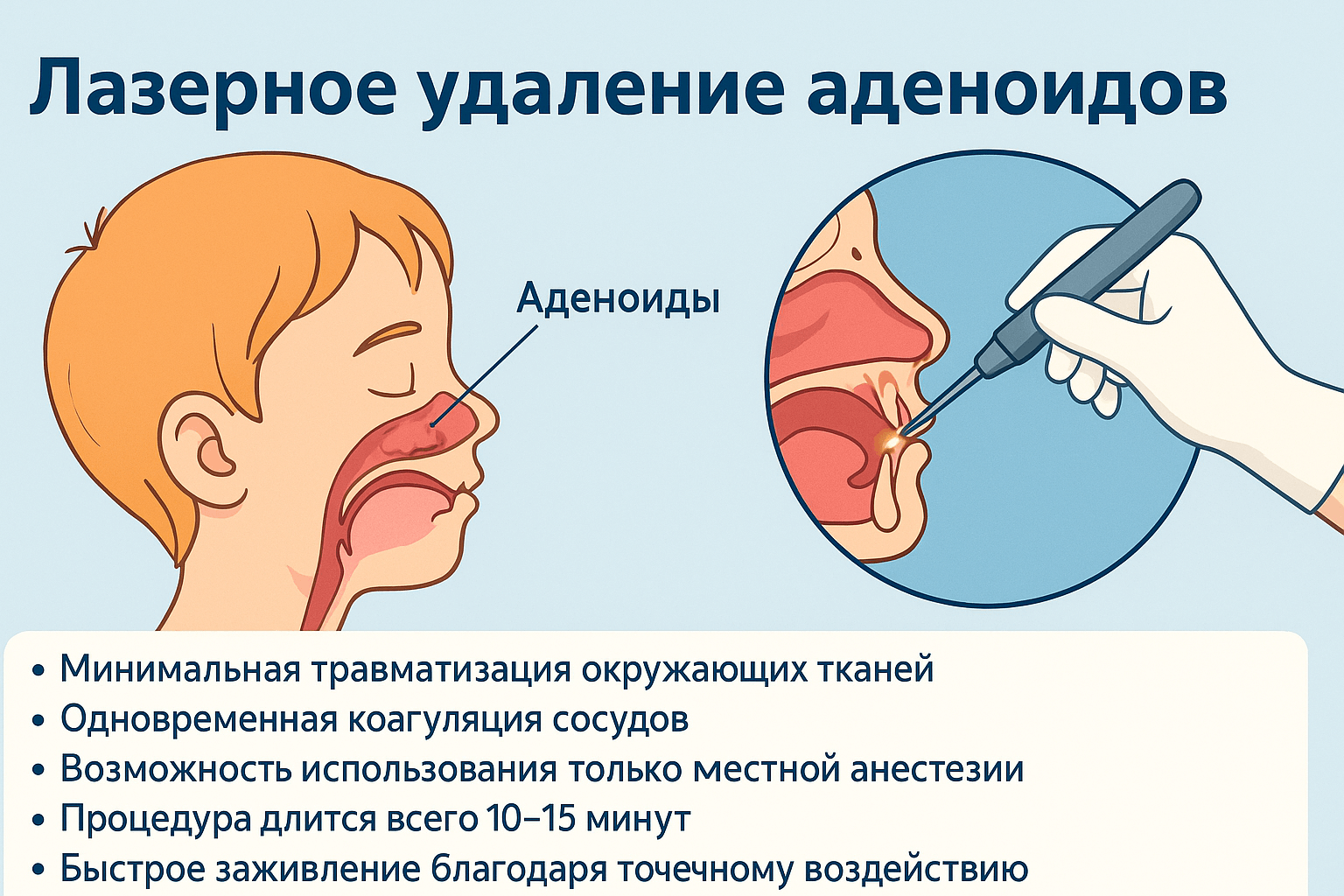 лазерное удаление аденоидов